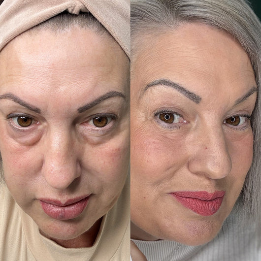 OptiZEN™ Révélez l’éclat naturel de votre regard