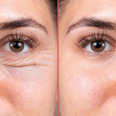 OptiZEN™ Masseur anti-cernes