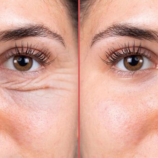 OptiZEN™ Masseur anti-cernes