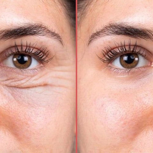 OptiZEN™ Masseur anti-cernes