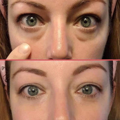 OptiZEN™ Masseur anti-cernes