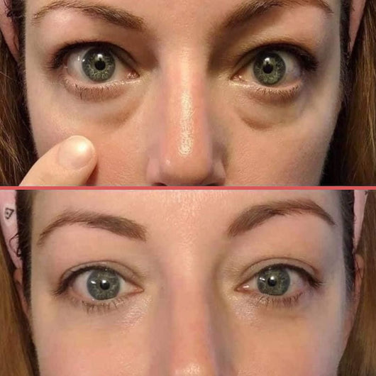 OptiZEN™ Masseur anti-cernes