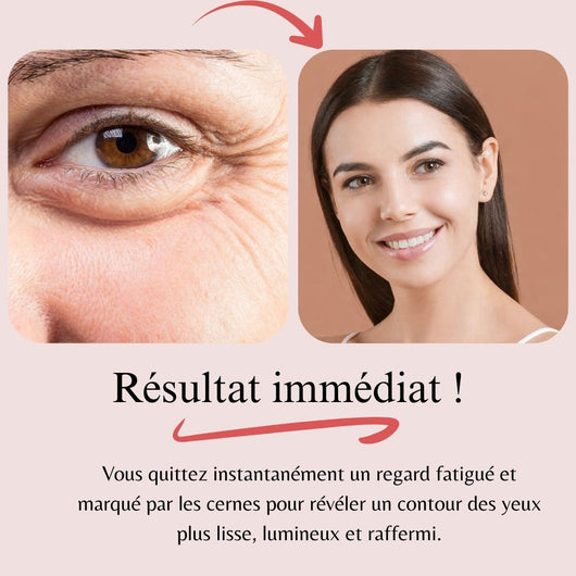 OptiZEN™ Masseur anti-cernes